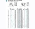 Anatomic Tooth Forceps English Pattern Lo and Wisdoms Left